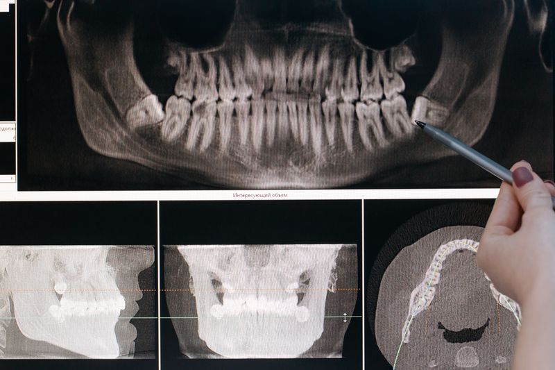 Endodoncia